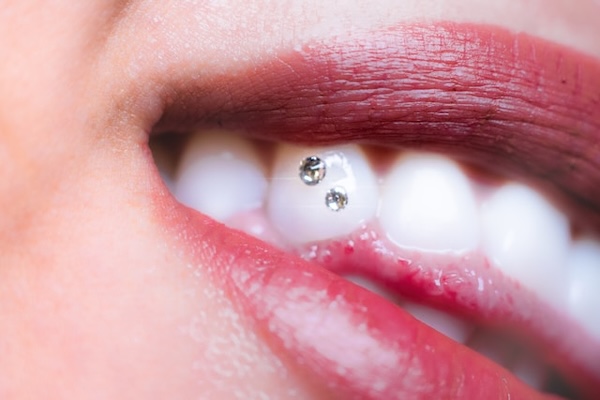 Teeth Span